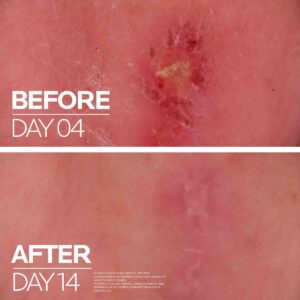 La Roche-Posay Cicaplast Baume B5+ 40ml – Soothing Multi-Purpose Repairing Balm becool maroc