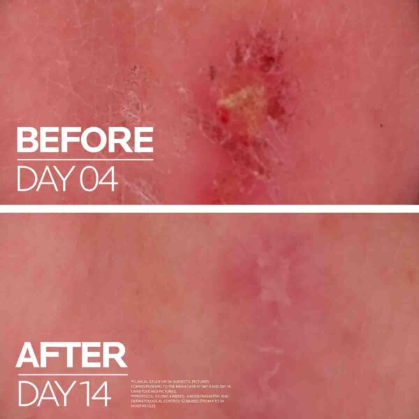 La Roche-Posay Cicaplast Baume B5+ 40ml – Soothing Multi-Purpose Repairing Balm becool maroc